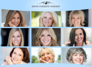 gallery of facelift and mini facelift results